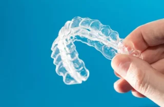 Do You Qualify for Invisalign Treatment in Jacksonville, FL